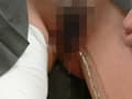 尿を垂れ流す包帯少女 サンプル画像 4