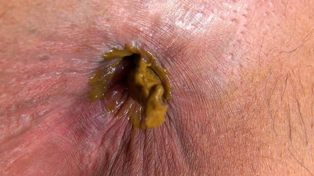 頭上要注意！ 糞壷ビューイング 第2集 サンプル画像 5